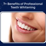 Benefits of Professional Teeth Whitening