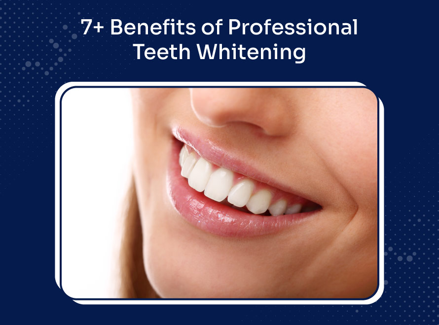 Benefits of Professional Teeth Whitening