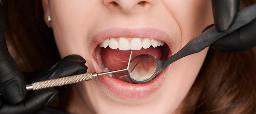 Advanced-Gum-Treatments