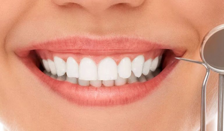 Cosmetic Dentistry