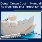Dental Crown Cost in Mumbai: The True Price of a Perfect Smile