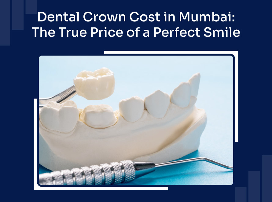 Dental Crown Cost in Mumbai: The True Price of a Perfect Smile