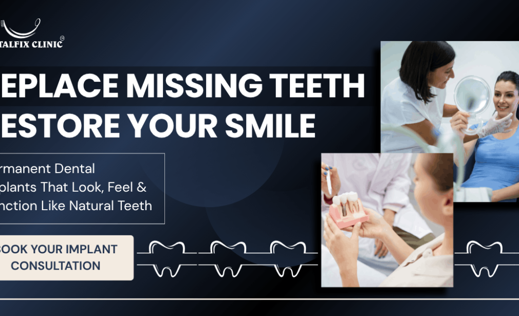 Dental implants