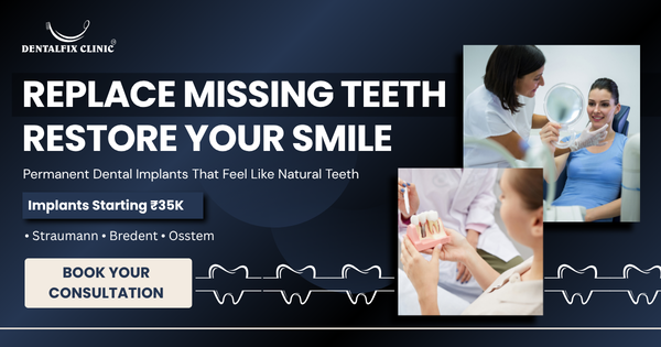 Dental Implants 1 Dental implants 3