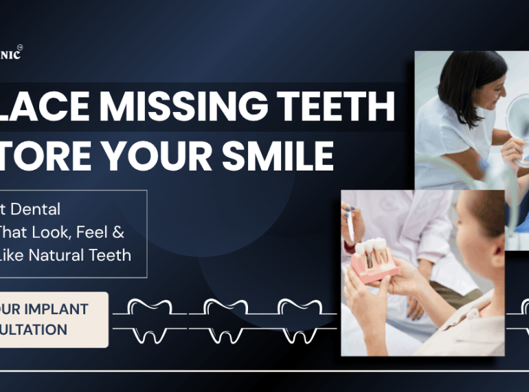 Dental Implants 1 Dental implants