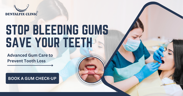 Advanced Gum Treatments (Periodontics) 1 Gum Problem