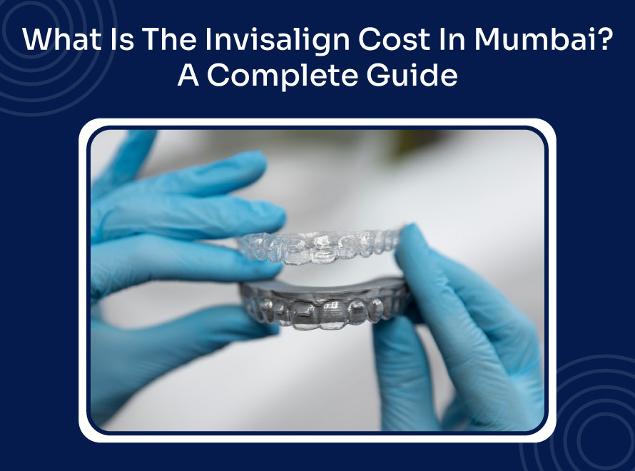What Is The Invisalign Cost In Mumbai? A Complete Guide